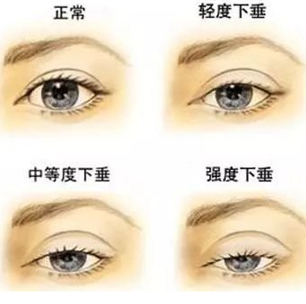 /Public/ueditor/php/upload/image/20181119/1542611811159055.png