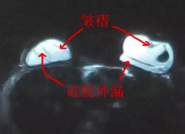 /Public/ueditor/php/upload/image/20181120/1542699595157871.jpg