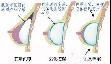 /Public/ueditor/php/upload/image/20181120/1542699800185177.jpg