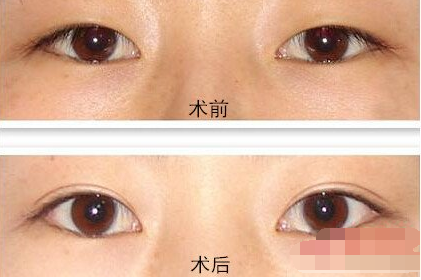 /Public/ueditor/php/upload/image/20181120/1542703396797886.png
