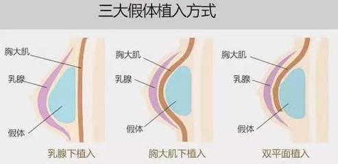 /Public/ueditor/php/upload/image/20181121/1542789605400420.jpg