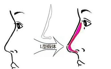 /Public/ueditor/php/upload/image/20181122/1542855219452391.png