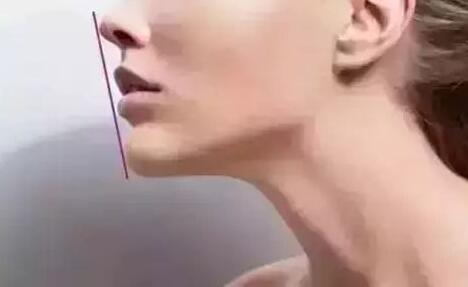 /Public/ueditor/php/upload/image/20181122/1542870933510453.jpg