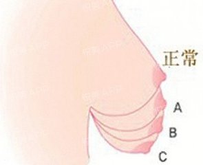 /Public/ueditor/php/upload/image/20181123/1542958892576469.jpg