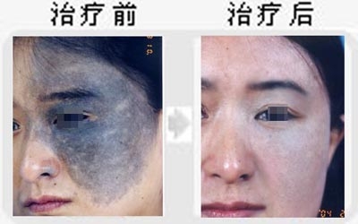 /Public/ueditor/php/upload/image/20181127/1543305630831092.jpg