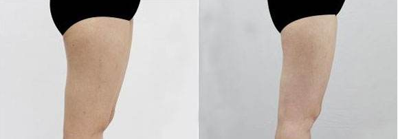 /Public/ueditor/php/upload/image/20181201/1543647250697955.png