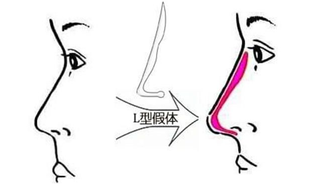 /Public/ueditor/php/upload/image/20181205/1543976978557697.png