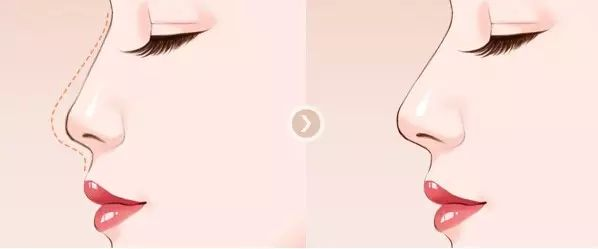 /Public/ueditor/php/upload/image/20181205/1543980926379287.png