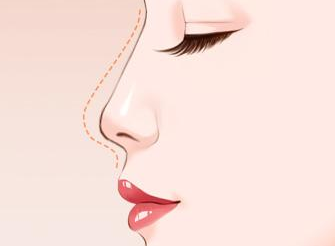 /Public/ueditor/php/upload/image/20181207/1544166044953325.png