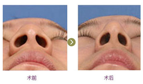 /Public/ueditor/php/upload/image/20181210/1544421277508377.jpg