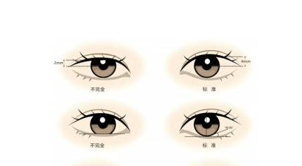 /Public/ueditor/php/upload/image/20181212/1544584195351982.png