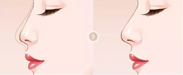 /Public/ueditor/php/upload/image/20181214/1544768099143030.png