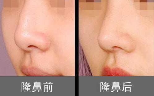 /Public/ueditor/php/upload/image/20181214/1544775811579982.jpg