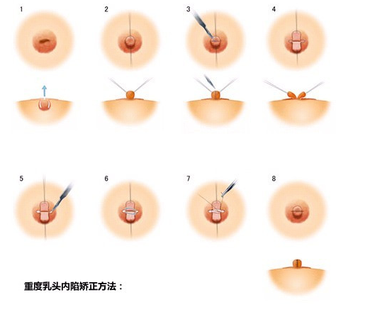 /Public/ueditor/php/upload/image/20181217/1545027549770274.png