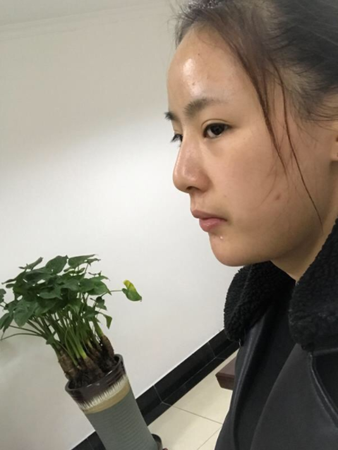 /Public/ueditor/php/upload/image/20181220/1545288687840299.png