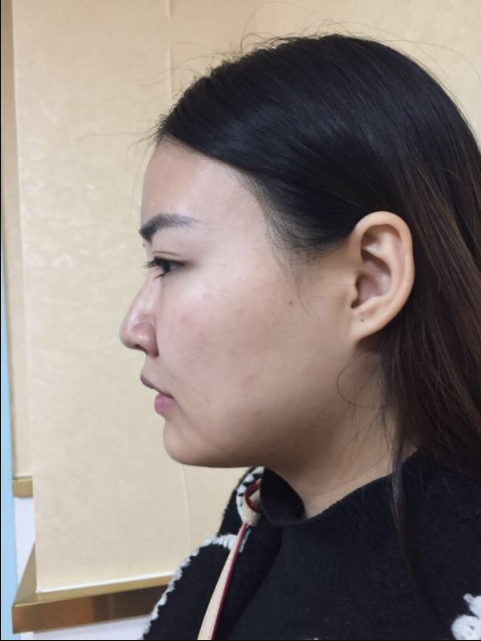 /Public/ueditor/php/upload/image/20181220/1545292537661892.png