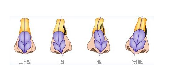 /Public/ueditor/php/upload/image/20181223/1545553952840696.png