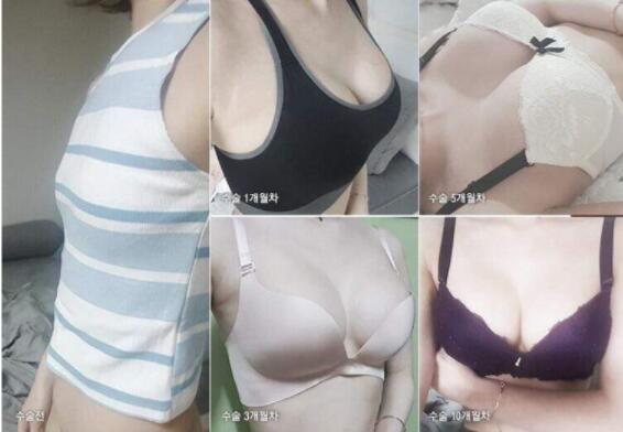 /Public/ueditor/php/upload/image/20181226/1545815536199259.jpg
