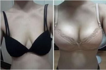 /Public/ueditor/php/upload/image/20181227/1545895334180036.png