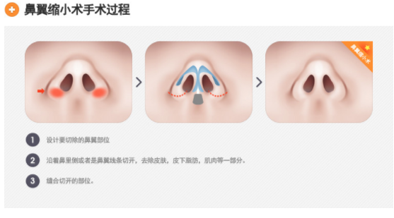 /Public/ueditor/php/upload/image/20181228/1545981306482647.png