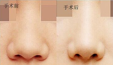 /Public/ueditor/php/upload/image/20181228/1545986867938720.png