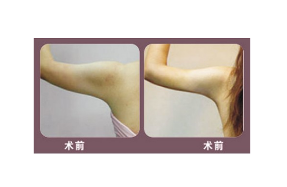 /Public/ueditor/php/upload/image/20181229/1546074385395692.png