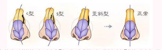 /Public/ueditor/php/upload/image/20190104/1546584307487934.png