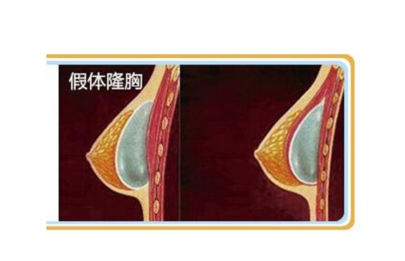 /Public/ueditor/php/upload/image/20190104/1546587969188501.png