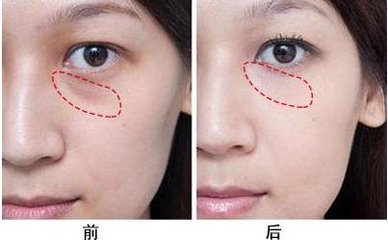 /Public/ueditor/php/upload/image/20190107/1546850040332878.jpg