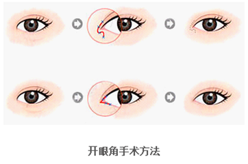 /Public/ueditor/php/upload/image/20190107/1546851370241135.png