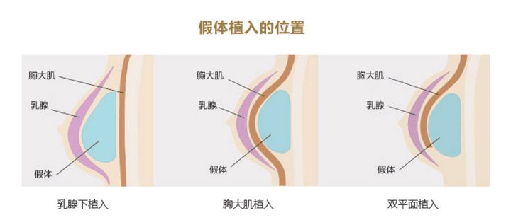/Public/ueditor/php/upload/image/20190107/1546855176251975.png