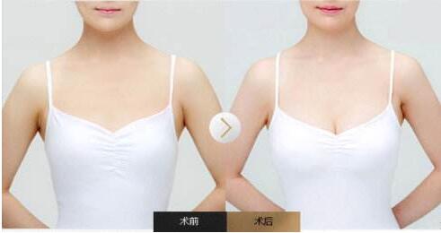 /Public/ueditor/php/upload/image/20190108/1546934417515230.jpg