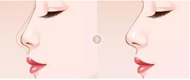 /Public/ueditor/php/upload/image/20190109/1547017318525940.png