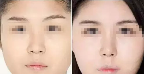 /Public/ueditor/php/upload/image/20190109/1547017821349237.png