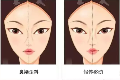 /Public/ueditor/php/upload/image/20190109/1547017848132395.png