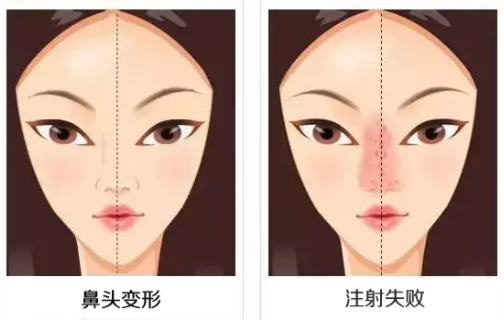/Public/ueditor/php/upload/image/20190109/1547017958862838.png