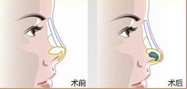 /Public/ueditor/php/upload/image/20190111/1547171235975781.png