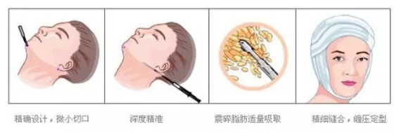 /Public/ueditor/php/upload/image/20190111/1547194199254170.png