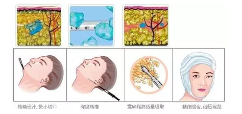 /Public/ueditor/php/upload/image/20190111/1547195509464990.png