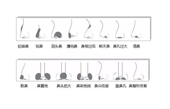 /Public/ueditor/php/upload/image/20190113/1547362062591793.png