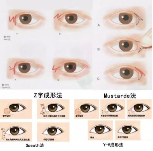 /Public/ueditor/php/upload/image/20190116/1547620751634993.png