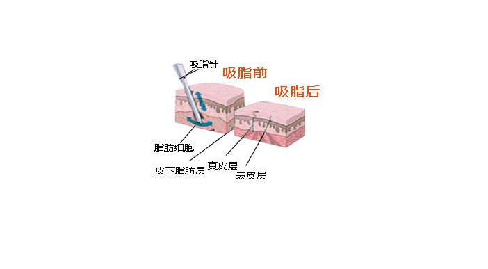 /Public/ueditor/php/upload/image/20190117/1547707594814225.png