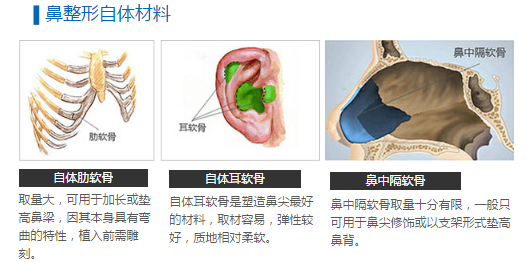 /Public/ueditor/php/upload/image/20190117/1547710786103083.png