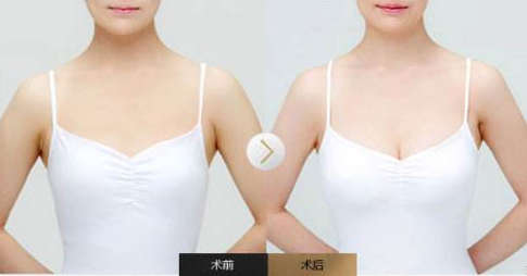/Public/ueditor/php/upload/image/20190118/1547799631581428.png