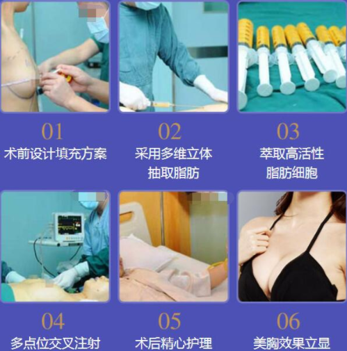 /Public/ueditor/php/upload/image/20190118/1547802416494997.png