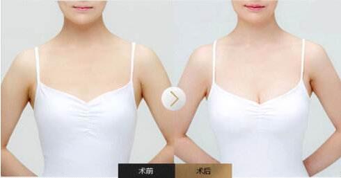 /Public/ueditor/php/upload/image/20190121/1548053738895224.jpg