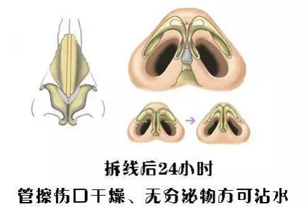 /Public/ueditor/php/upload/image/20190123/1548224640944732.png