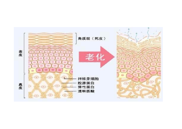 /Public/ueditor/php/upload/image/20190123/1548230868730908.png