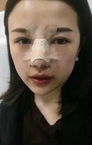 /Public/ueditor/php/upload/image/20190124/1548319097822196.png