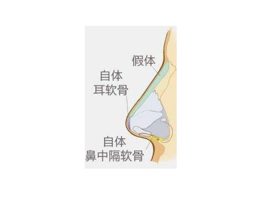 /Public/ueditor/php/upload/image/20190125/1548400858417342.png